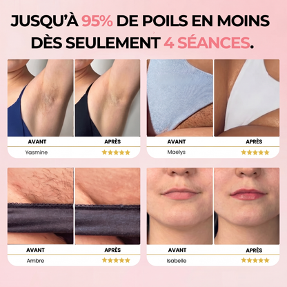 Léa Skin IPL Pulse + Kit offert lea-skin.com